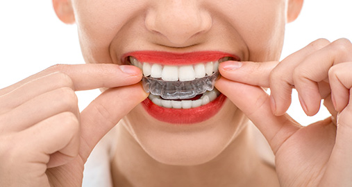 Invisalign vs. Braces: Which Is Better? - Abraham Orthodontics